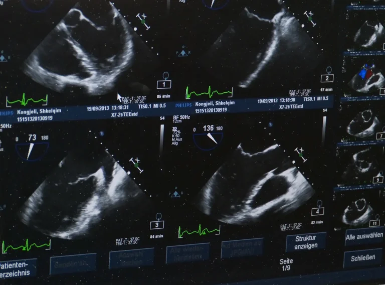 Advances in Ultrasound Technology Revolutionize Medical Diagnostics